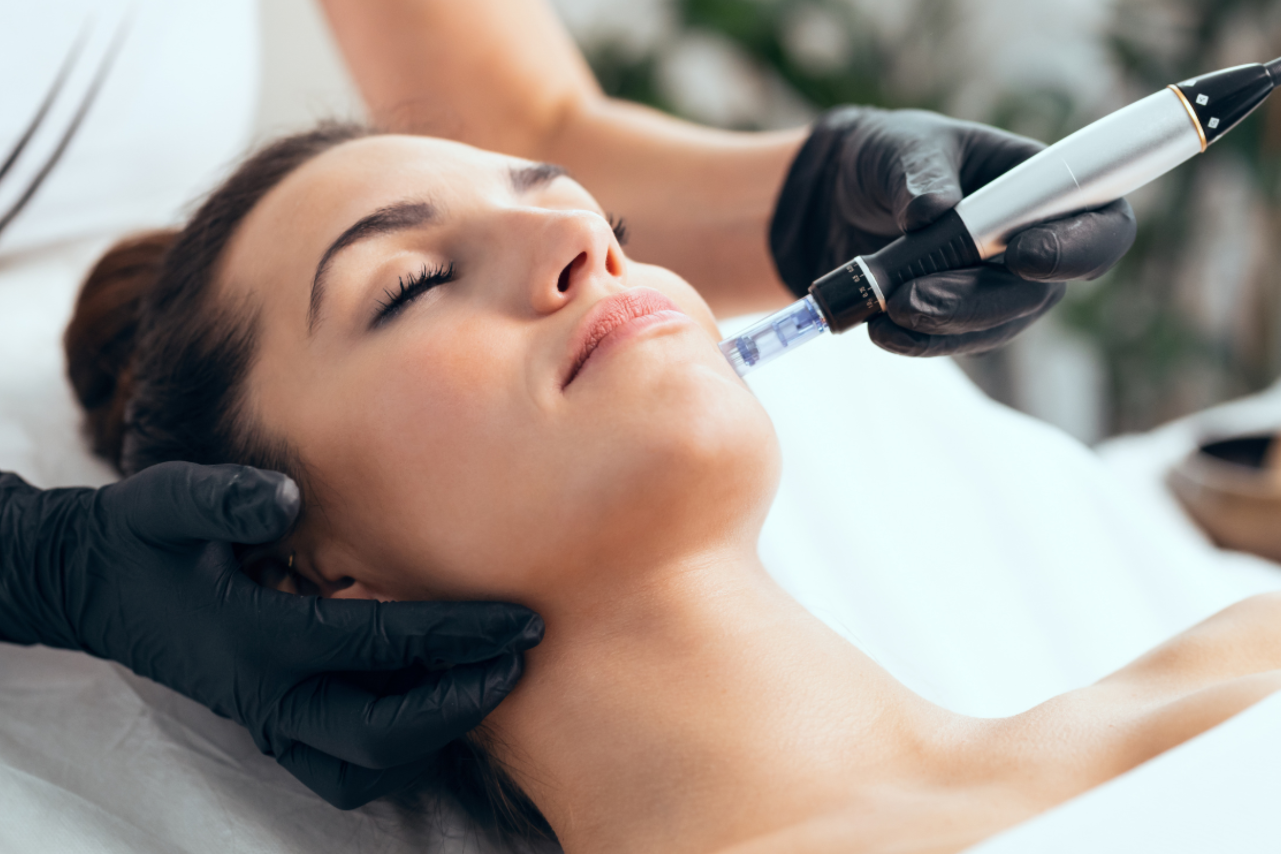 Microneedling & Haarinfusie  Microneedling met actieve serums om haargroei te stimuleren en de hoofdhuid te versterken. 
 Boek Nu